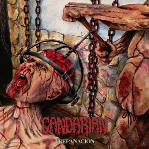 Trepanación